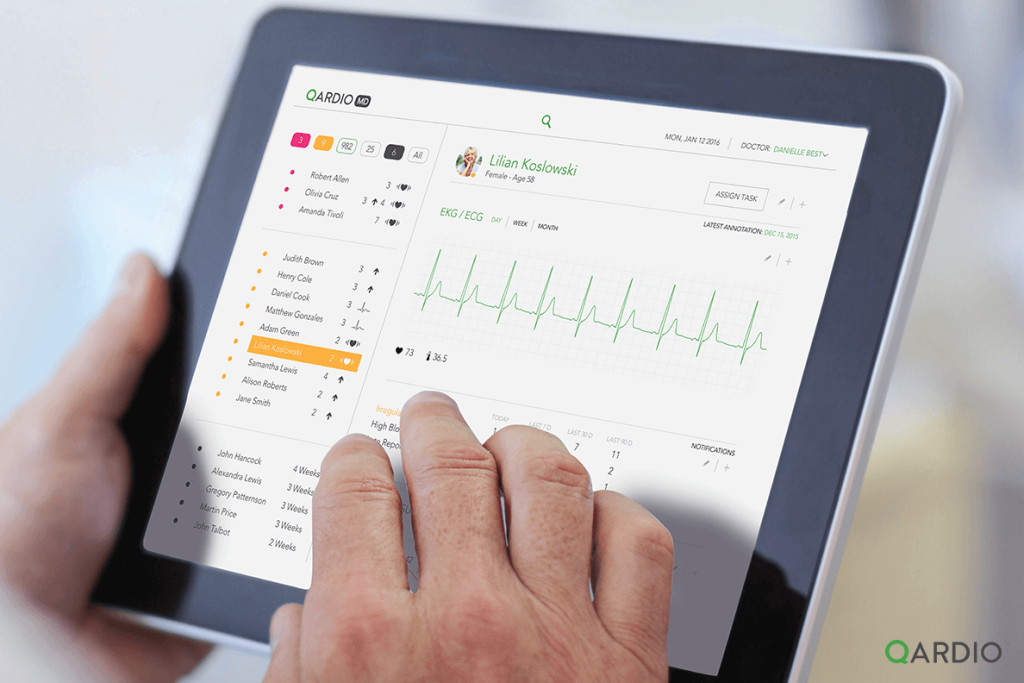 How does ECG/EKG work and what is an ECG/EKG monitor?