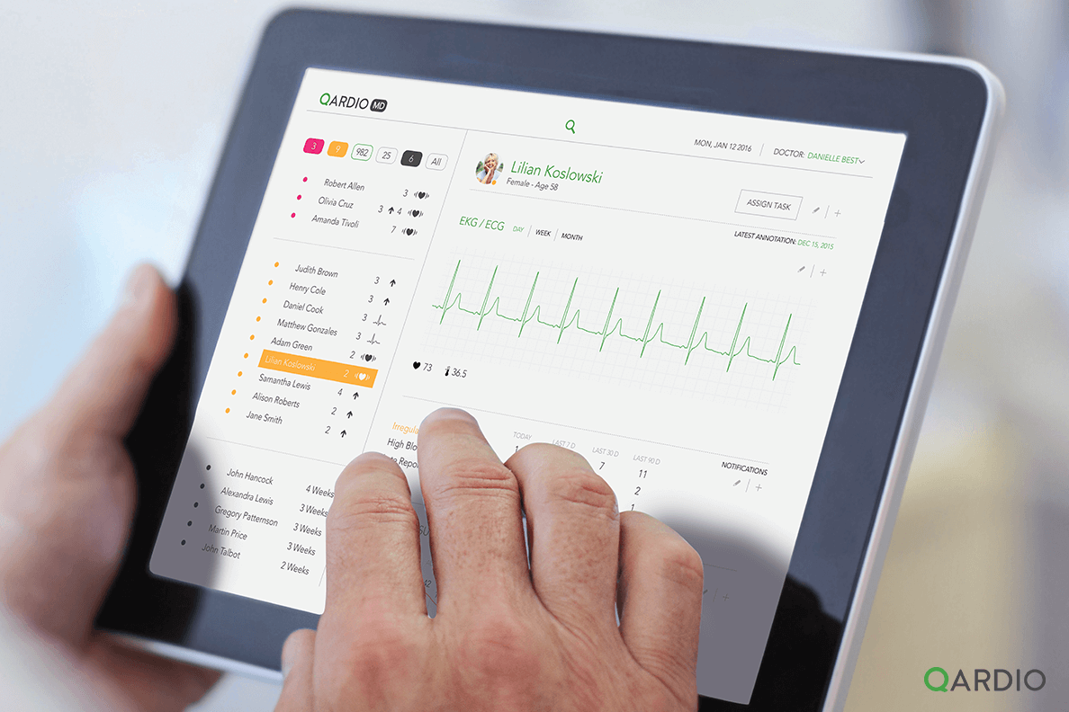 how-does-ecgekg-work-and-what-is-an-ecgekg-monitor