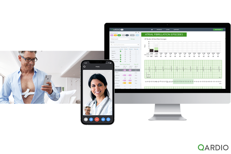 What are the benefits of remote ECG monitoring?