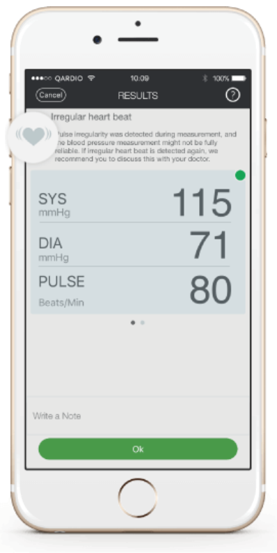 QardioApp Irregular Heart Beats