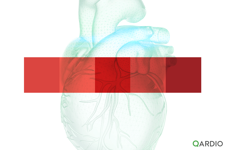 importance-rpm-patients-living-heart-failure