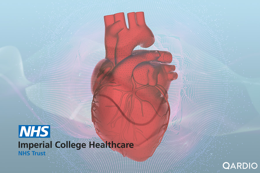 SHOCK-HF trial, a clinical trial with Imperial College and QardioCore