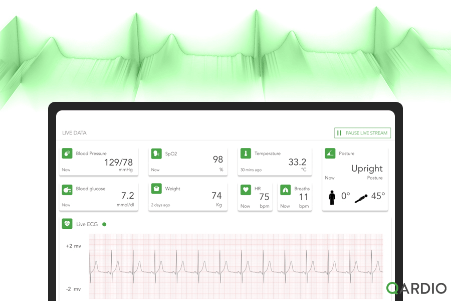 Qardio Introduces Revolutionary Livestream ECG Monitoring and Advances Healthcare